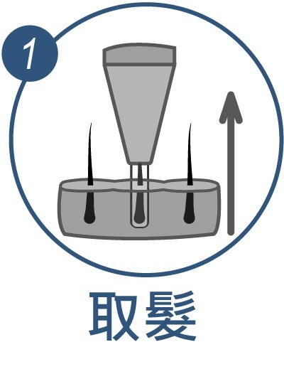 H&H醫髮診所-台北植髮診所-新竹植髮診所-台中植髮診所-植髮費用-雄性禿-植髮診所推薦-植髮經驗-植髮價格-植髮經驗分享-植髮費用-植髮失敗-植髮推薦-植髮價錢-植髮心得-韓式植髮-美式植髮-植髮ptt-植髮效果-植髮fue-植髮fut-植髮機器人