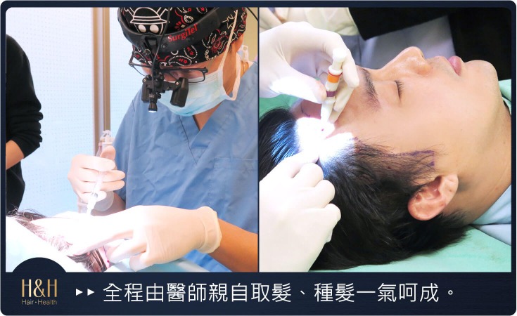 韓式美型植髮手術過程_H&H