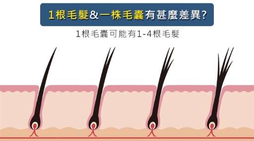 植髮費用價格_根株差異_H&H醫髮