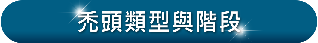 禿頭髮型_禿頭類型及階段_H&H醫髮