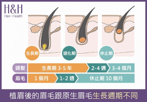 紋繡(紋綉)_擬真紋繡髮_H&H醫髮