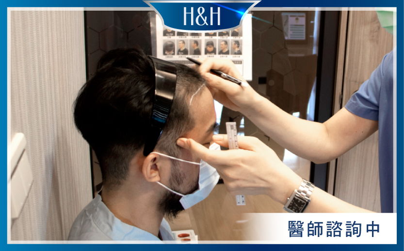 植髮案例分享-完整植髮流程，網紅超粒方親試見證-H&H