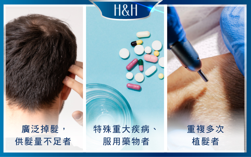 植髮適應對象- 3種類型不適合植髮手術對象-H&H